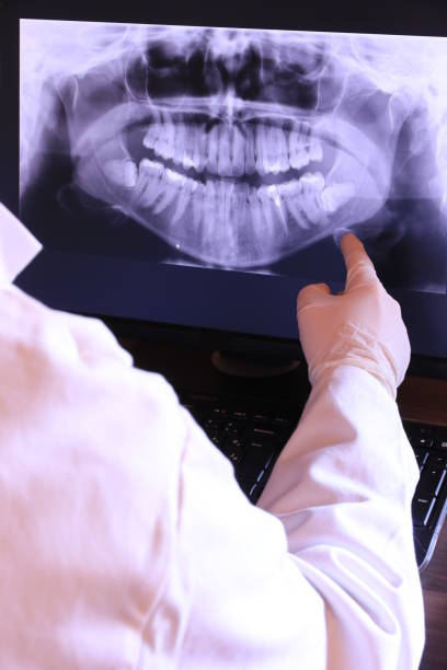 Best Emergency Root Canal Treatment in Marmet, WV