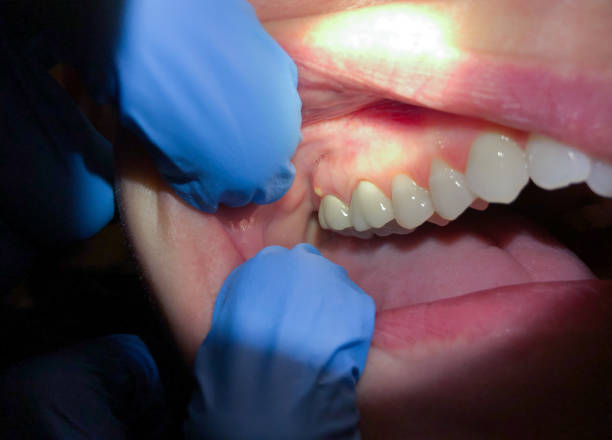 Best 24-Hour Emergency Dentist in Marmet, WV